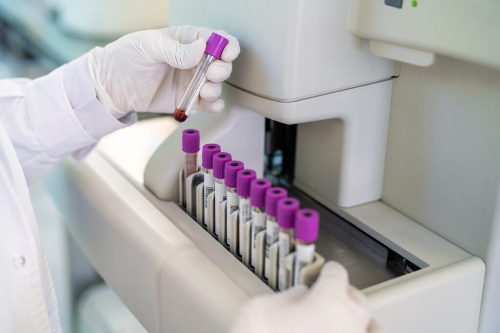 Doctor holding vial of blood in micronutrient testing